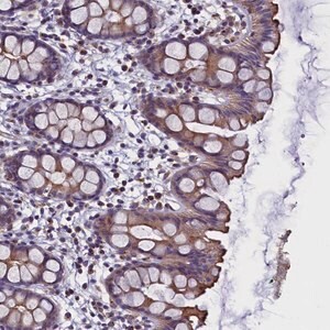 Merck Anti-STK32A antibody produced in rabbit