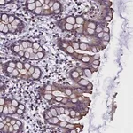 Merck Anti-STK32A antibody produced in rabbit
