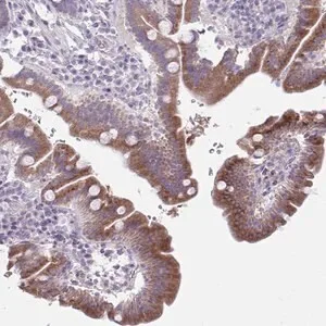 Merck Anti-PLA2G12B antibody produced in rabbit