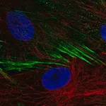 Merck Anti-SCN9A antibody produced in rabbit