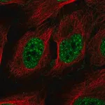 Merck Anti-RAD52 antibody produced in rabbit