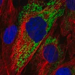 Merck Anti-COL11A1 antibody produced in rabbit