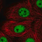 Merck Anti-TBX2 antibody produced in rabbit