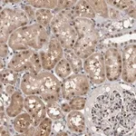 Merck Anti-ZSCAN21 antibody produced in rabbit