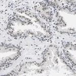 Merck Anti-ATF2 antibody produced in rabbit