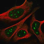 Merck Anti-NPR1 antibody produced in rabbit