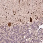 Merck Anti-ALKBH8 antibody produced in rabbit