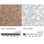 Merck Anti-GLUL antibody produced in rabbit