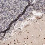 Merck Anti-CHM antibody produced in rabbit