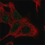 Merck Anti-UCK2 antibody produced in rabbit