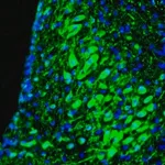 Merck Anti-RAP1GAP antibody produced in rabbit
