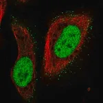 Merck Anti-PMS2 antibody produced in rabbit