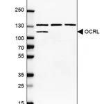 Merck Anti-OCRL antibody produced in rabbit