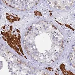 Merck Anti-UBE2O antibody produced in rabbit