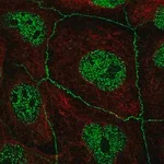 Merck Anti-C16ORF59 antibody produced in rabbit