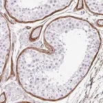 Merck Anti-LOXL4 antibody produced in rabbit