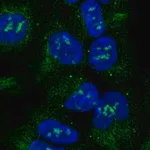 Merck Anti-ACVR1 antibody produced in rabbit