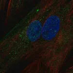 Merck Anti-IGFBP5 antibody produced in rabbit