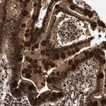 Merck Anti-RBM5 antibody produced in rabbit