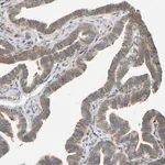 Merck Anti-RPS14 antibody produced in rabbit