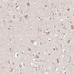 Merck Anti-TSC2 antibody produced in rabbit