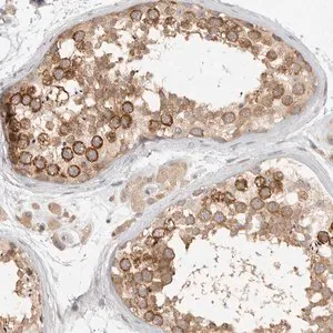 Merck Anti-HDAC6 antibody produced in rabbit