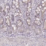 Merck Anti-CENPH antibody produced in rabbit