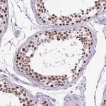 Merck Anti-VCX antibody produced in rabbit