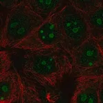Merck Anti-RPL22L1 antibody produced in rabbit