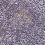 Merck Anti-ALKBH8 antibody produced in rabbit