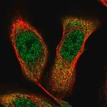 Merck Anti-NKX2-5 antibody produced in rabbit