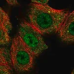 Merck Anti-CNOT10 antibody produced in rabbit