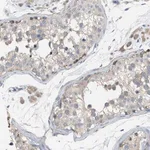 Merck Anti-UBAP2 antibody produced in rabbit