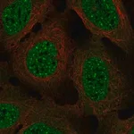 Merck Anti-NDC80 antibody produced in rabbit