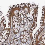 Merck Anti-ST8SIA6 antibody produced in rabbit