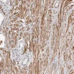 Merck Anti-UNK antibody produced in rabbit