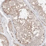 Merck Anti-CEP162 antibody produced in rabbit