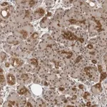 Merck Anti-EXOSC10 antibody produced in rabbit