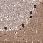 Merck Anti-AP2M1 antibody produced in rabbit