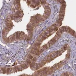 Merck Anti-BICD1 antibody produced in rabbit