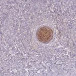 Merck Anti-ST3GAL4 antibody produced in rabbit