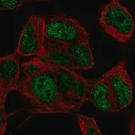 Merck Anti-TLX3 antibody produced in rabbit
