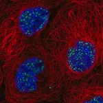 Merck Anti-SON antibody produced in rabbit