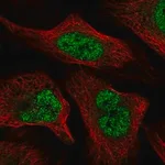 Merck Anti-WAC antibody produced in rabbit