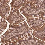 Merck Anti-SYMPK antibody produced in rabbit