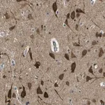 Merck Anti-KCTD10 antibody produced in rabbit