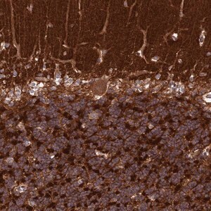 Merck Anti-IGLON5 antibody produced in rabbit