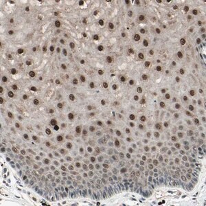 Merck Anti-NUAK2 antibody produced in rabbit