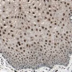 Merck Anti-NUAK2 antibody produced in rabbit