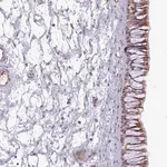 Merck Anti-C1QTNF5 antibody produced in rabbit